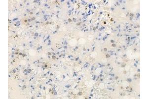 ABIN6258611 and ABIN6274252 at 1/100 staining human normal lung tissue by IHC-P.