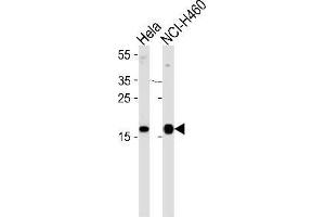 Western blot analysis of NDP kinase A Antibody (C-term) Cat. (NME1 antibody  (C-Term))