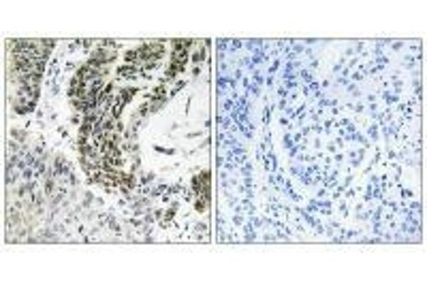 RREB1 antibody