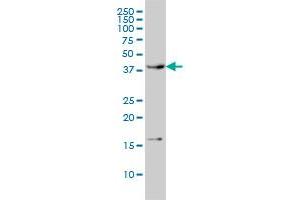 CAMK1 monoclonal antibody (M01), clone 3G1 Western Blot analysis of CAMK1 expression in HL-60 . (CAMK1 antibody  (AA 271-370))