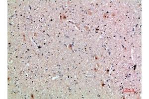 Immunohistochemistry (IHC) image for anti-C-Type Lectin Domain Family 4, Member A (CLEC4A) (AA 161-210) antibody (ABIN7180295)