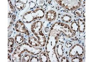 Immunohistochemical staining of paraffin-embedded Kidney tissue using anti-NPR3 mouse monoclonal antibody. (NPR3 antibody)