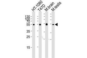 Western blot analysis of lysate from HT-1080, T47D cell line, mouse brain and testis tissue lysate using TUBA6 antibody at 1:1000.