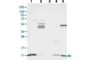 Western blot analysis of Lane 1: RT-4, Lane 2: U-251 MG, Lane 3: Human Plasma, Lane 4: Liver, Lane 5: Tonsil with SH3BGRL3 polyclonal antibody .