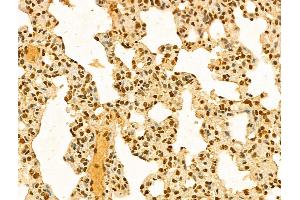 ABIN7094285 and ABIN7098332 at 1/100 staining Rat lung tissue by IHC-P. (HP1BP3 antibody  (Internal Region))