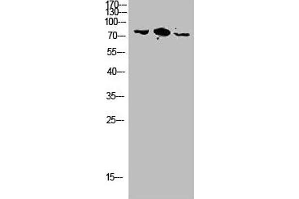 RHOBTB3 antibody  (Internal Region)