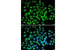 Immunofluorescence analysis of U2OS cells using MECP2 antibody (ABIN6134134, ABIN6143680, ABIN6143682 and ABIN6217279). (MECP2 antibody  (AA 1-100))