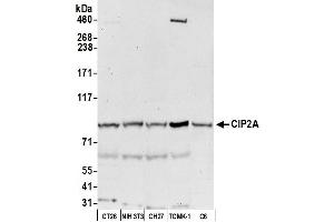 Western Blotting (WB) image for anti-KIAA1524 (KIAA1524) (AA 853-903) antibody (ABIN7453880)