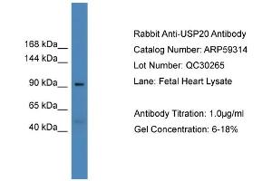 WB Suggested Anti-USP20  Antibody Titration: 0. (USP20 antibody  (Middle Region))