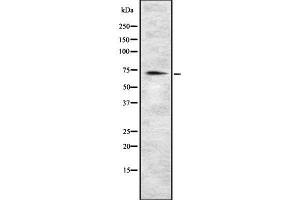 Western blot analysis of MIC1 using HeLa whole cell lysates (C18orf8 antibody  (C-Term))