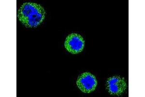 Confocal immunofluorescent analysis of CD1E Antibody (Center)(Cat#AP50840PU-N) with MDA-MB435 cell followed by Alexa Fluor 488-conjugated goat anti-rabbit lgG (green). (CD1e antibody  (Middle Region))
