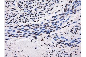 Immunohistochemistry (IHC) image for anti-Sorbitol Dehydrogenase (SORD) antibody (ABIN1501077) (SORD antibody)