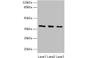 Western blot All lanes: GALE antibody at 2 μg/mL Lane 1: HepG2 whole cell lysate Lane 2: Hela whole cell lysate Lane 3: A549 whole cell lysate Secondary Goat polyclonal to rabbit IgG at 1/10000 dilution Predicted band size: 39, 31 kDa Observed band size: 39 kDa