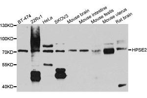Western blot analysis of extracts of various cell lines, using HPSE2 antibody. (Heparanase 2 antibody  (AA 42-242))