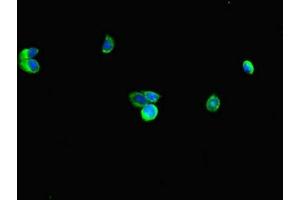 Immunofluorescent analysis of HepG2 cells using ABIN7151194 at dilution of 1:100 and Alexa Fluor 488-congugated AffiniPure Goat Anti-Rabbit IgG(H+L) (RNF4 antibody  (AA 1-103))