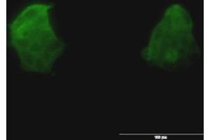 Immunofluorescence of monoclonal antibody to TSPAN8 on 293 cell. (Tspan-8 antibody  (AA 110-205))