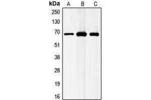 Western blot analysis of GABRB1 expression in MCF7 (A), mouse liver (B), rat liver (C) whole cell lysates. (GABRB1 antibody  (C-Term))