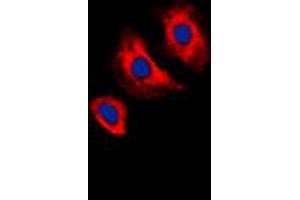 Immunofluorescent analysis of VEGFR2 (pY1175) staining in MCF7 cells. (VEGFR2/CD309 antibody  (C-Term, pTyr1175))