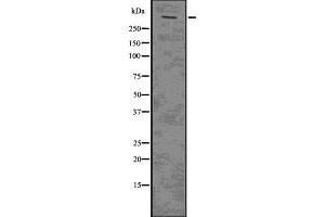 Western blot analysis of PLEC using Jurkat whole  lysates. (PLEC antibody  (N-Term))