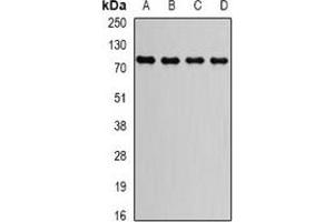 Western blot analysis of GGA2 expression in HepG2 (A), Raji (B), MCF7 (C), mouse brain (D) whole cell lysates. (GGA2 antibody)