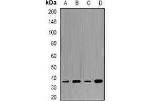 Western blot analysis of Tropomyosin expression in SW480 (A), MCF7 (B), mouse heart (C), mouse brain (D) whole cell lysates. (Tropomyosin antibody)