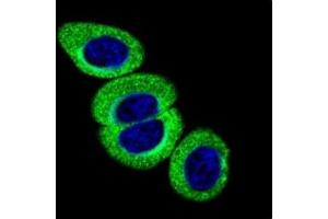 Confocal immunofluorescent analysis of phospho-ATM antibody with HeLa cells followed by Alexa Fluor 488-conjugated goat anti-rabbit lgG (green). (ATM antibody  (pSer1981))