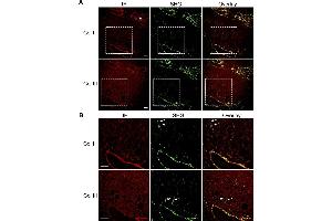 Immunofluorescence (IF) image for anti-COL1A2/COL1A1 antibody (ABIN5596819)