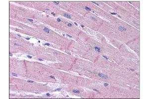 Human Heart: Formalin-Fixed, Paraffin-Embedded (FFPE) (KCNK18 antibody)