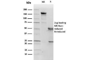 SDS-PAGE Analysis Purified p57 Monoclonal Antibody (KP10).