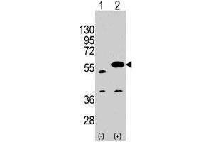 SPRED1 antibody  (C-Term)