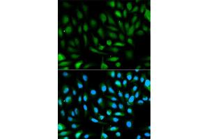 Immunofluorescence analysis of HeLa cell using PARK7 antibody. (PARK7/DJ1 antibody  (AA 1-189))