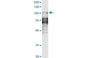 Desmocollin 2 anticorps  (AA 444-534)