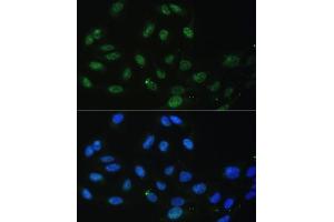 Immunofluorescence analysis of U-2 OS cells using DDX50 antibody (ABIN6129371, ABIN6139509, ABIN6139510 and ABIN6224730) at dilution of 1:100. (DDX50 antibody  (AA 1-135))
