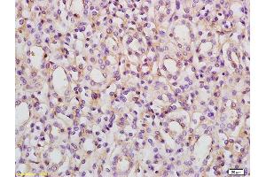 Formalin-fixed and paraffin embedded rat kidney labeled with Rabbit Anti ACVR1B/ALK4 Polyclonal Antibody, Unconjugated (ABIN761231) at 1:200 followed by conjugation to the secondary antibody and DAB staining (Activin A Receptor Type IB/ALK-4 antibody  (AA 51-150))