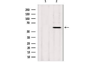CYP26B1 antibody  (Internal Region)
