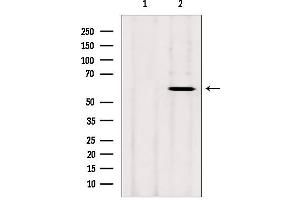 Western blot analysis of extracts from rat heart, using CYP26B1 antibody. (CYP26B1 antibody  (Internal Region))