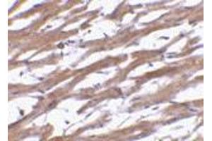 Immunohistochemistry of BAP29 in human heart tissue with BAP29 antibody at 10 μg/ml.