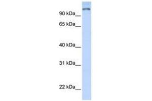 Image no. 1 for anti-Poly (ADP-Ribose) Polymerase Family, Member 9 (PARP9) (AA 144-193) antibody (ABIN6740354) (PARP9 antibody  (AA 144-193))