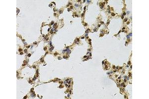 Immunohistochemistry (Paraffin-embedded Sections) (IHC (p)) image for anti-Interferon, gamma-Inducible Protein 16 (IFI16) antibody (ABIN7257561)