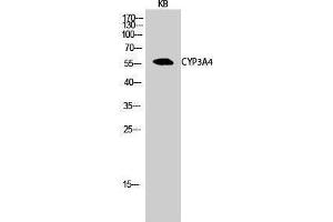 Western Blotting (WB) image for anti-Cytochrome P450, Family 3, Subfamily A, Polypeptide 4 (CYP3A4) (Internal Region) antibody (ABIN6284543) (CYP3A4 antibody  (Internal Region))