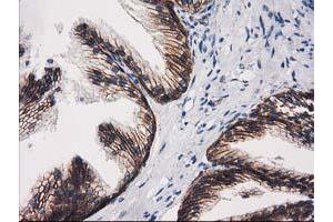 Image no. 2 for anti-Catenin (Cadherin-Associated Protein), beta 1, 88kDa (CTNNB1) antibody (ABIN1496893) (CTNNB1 antibody)