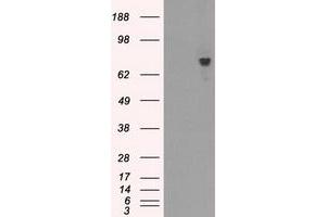 Image no. 5 for anti-Bruton Agammaglobulinemia tyrosine Kinase (BTK) antibody (ABIN1496976) (BTK antibody)