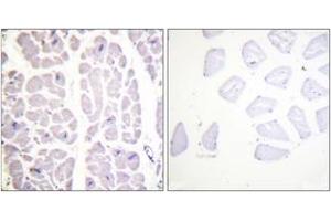 Immunohistochemistry analysis of paraffin-embedded human heart, using IKK-alpha/beta (Phospho-Ser180/181) Antibody. (IKK-alpha /IKK-beta antibody  (pSer180))