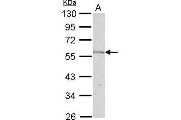 NUP50 antibody  (C-Term)