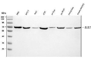 Western blot analysis of RARS/RARS1 using anti-RARS/RARS1 antibody (ABIN7600223). (Probable Arginine--tRNA Ligase, Cytoplasmic (RARS-1) (AA 165-425) antibody)