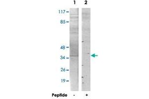 Western blot analysis of extracts from HT-29 cells, using PMEPA1 polyclonal antibody .
