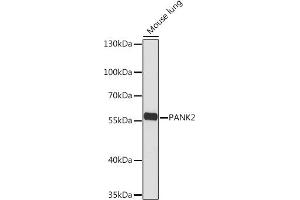 Western blot analysis of extracts of Mouse lung, using P Rabbit pAb (ABIN7269169) at 1:1000 dilution. (PANK2 antibody  (AA 300-400))