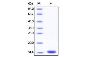 Human FKBP12, His Tag on SDS-PAGE under reducing (R) condition. (FKBP1A Protein (AA 1-108) (His tag))