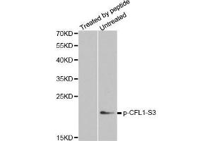 Western blot analysis of extracts from COLO205 cells, using phospho-CFL1-S3 antibody. (Cofilin antibody  (pSer3))
