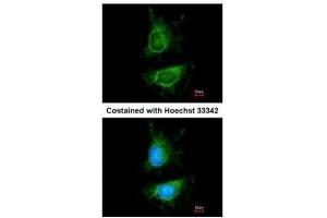 Immunofluorescence (IF) image for anti-Mdm2, p53 E3 Ubiquitin Protein Ligase Homolog (Mouse) (MDM2) (Center) antibody (ABIN2854782)